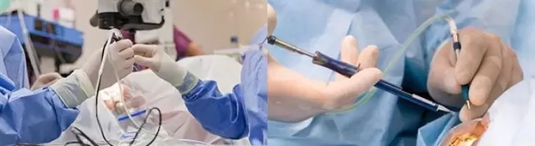 Operacja przywracająca wzrok